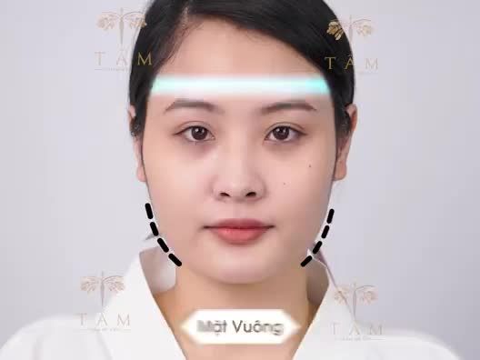 VLINE PERFECT THON GỌN HÀM - BÍ KÍP TẠO NÊN GƯƠNG MẶT HOÀN MỸ