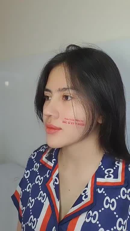 Bạn đang muốn có một chiếc mũi hoàn hảo?