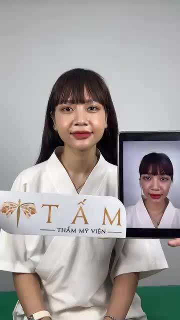 Combo filler má, cằm sẽ giúp bạn xinh đẹp trẻ trung như thế nào?