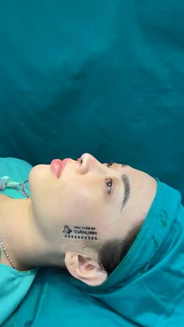 Case mũi cấu trúc cho bạn gái thích nhẹ nhàng tự nhiên
