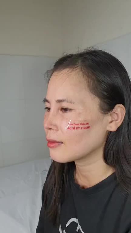 Tái khám mũi tại cơ sở Nha Trang