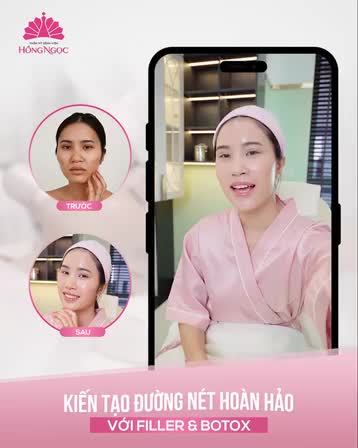 KHOE KẾT QUẢ KHÁCH HÀNG SAU KHI TIÊM FILLER BOTOX TẠI HỒNG NGỌC