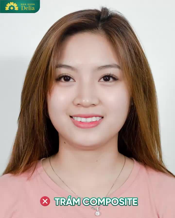 Chị Hương chia sẻ trải nghiệm làm răng sứ tại Delia qua video dưới đây nhé!