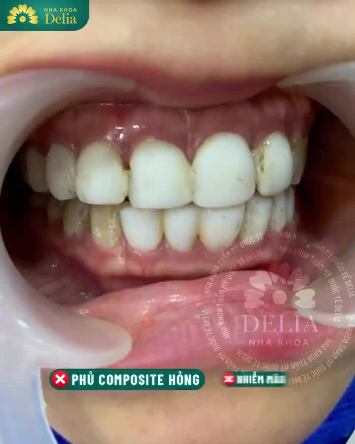 Nụ cười là một phần tất yếu của cuộc sống, và đối với những người làm mẫu ảnh như chị Hà Khánh Loan thì nụ cười đẹp còn đóng một vai quan trọng hơn nữa.