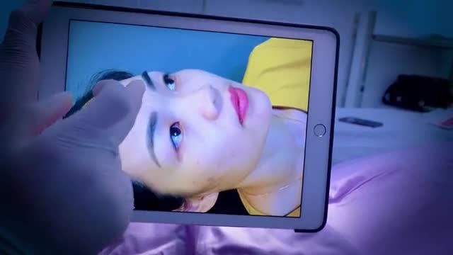 Nâng mũi vừa thực hiện xong đẹp quá nên phải khoe luôn cùng cả nhà cho nóng đây ạ