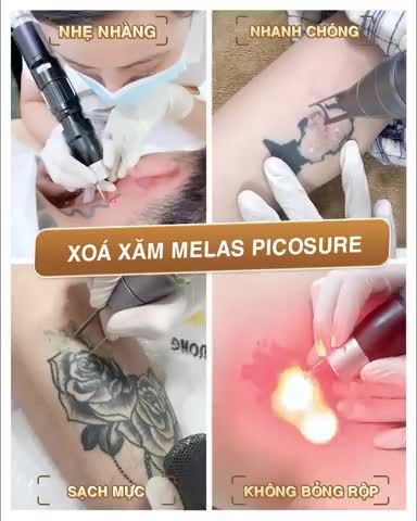 XÓA XĂM TẠI XUÂN HƯƠNG AN TOÀN VÀ HIỆU QUẢ NHƯ THẾ NÀO?