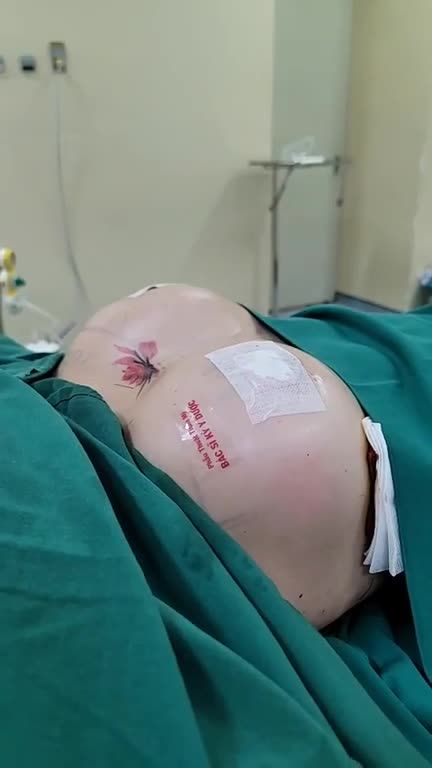 Chỉ 60 phút phẫu thuật, sở hữu ngay Vòng 1 căng tròn Khuôn ngực đầy đặn, tràn đầy sức sống tạo nên đường cong hoàn hảo khiến người đối diện không thể rời mắt.