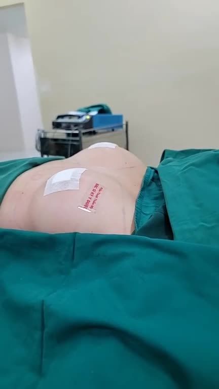 Bác sĩ Kỳ Y Dược vừa thực hiện thành công ca phẫu thuật Nâng ngực Nội soi chân không đường nách.