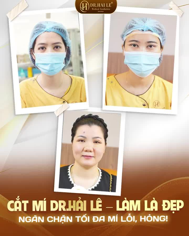 CẮT MÍ DR.HẢI LÊ - LÀM LÀ ĐẸP - NGĂN CHẶN TỐI ĐA MÍ LỖI, HỎNG!