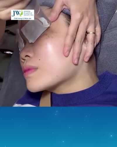 TIN ĐƯỢC KHÔNG! ƯU ĐÃI CỰC SỐC TRỊ NÁM ĐEO BÁM CHỈ CÒN 2.4 TRIỆU