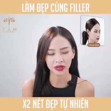 1001 lí do để chị em lựa chọn Combo Filler bên Thẩm Mỹ Viện Tấm