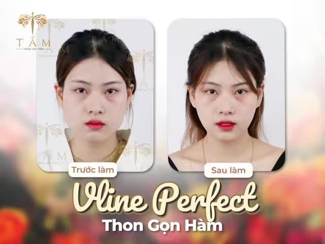 2023 rồi đừng để MẶT VUÔNG trở thành rào cản nhan sắc của bạn nữa!