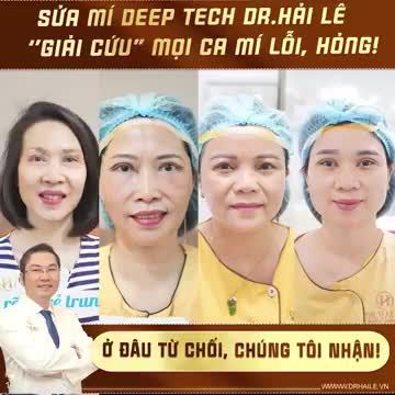 1 giờ 30 phút khắc phục hoàn toàn tình trạng lỗi, hỏng: đính cơ nâng mi sâu, mí xơ sẹo, mí trợn, mí lật...