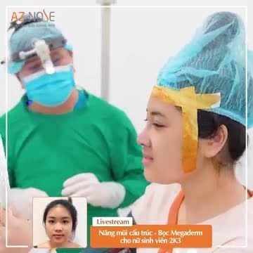Nâng mũi cấu trúc, sóng Surgiform, kết hợp bọc #Megaderm giúp hạn chế m.ỏng da cho nữ sinh viên 2K3