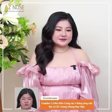 Tâm sự "chuyện nâng mũi" cùng Youtuber Quyên Emie Dáng mũi do bác sĩ CKI. Hoàng Nhung thực hiện.