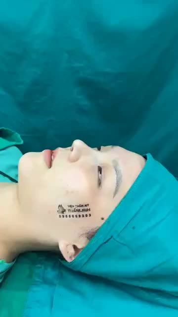 Case mũi cấu trúc vừa hoàn thành cho bạn gái thích nhẹ nhàng tự nhiên