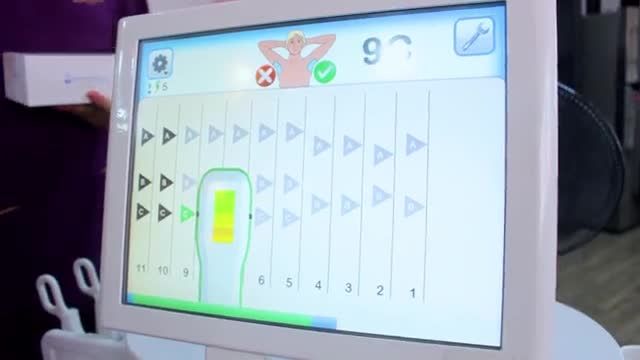 Điều trị hôi nách công nghệ miraDry hiệu quả vượt trội như thế nào? Theo dõi ngay