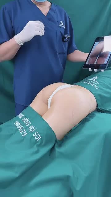 NÂNG MÔNG BẰNG MỠ TỰ THÂN - DÁNG ĐẸP CHỈ TRONG 1 LẦN THỰC HIỆN