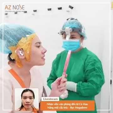 Nhân viên văn phòng đến từ Cà Mau nâng mũi cấu trúc, kết hợp bọc Megaderm giúp hạn chế mỏng da.