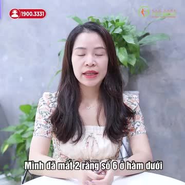 CẤY IMPLANT OSSTEM KHẮC PHỤC RĂNG HÀM MẤT LÂU NĂM