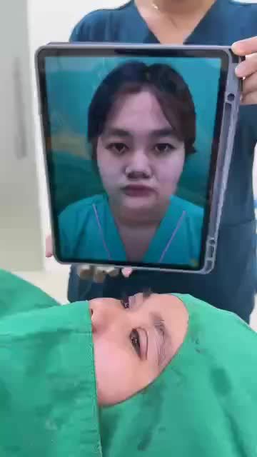 Ca cắt tạo mắt hai mí , lấy da dư và mỡ thừa