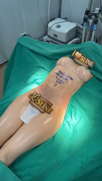 COMBO nâng ngực + Hút mỡ bụng.
