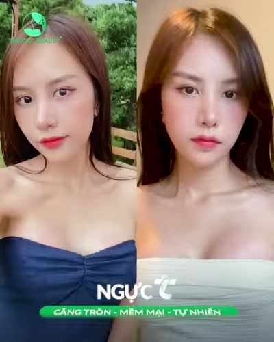 NÂNG CẤP V1 - ƯU ĐÃI TRỌN GÓI
