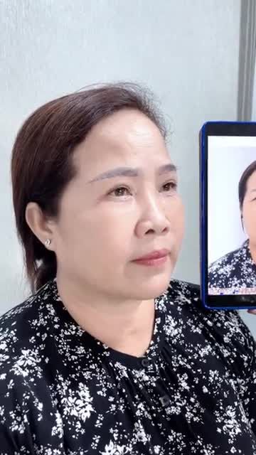 TÁI KHÁM 7 NGÀY CHO KHÁCH NÂNG CUNG MÀY VÀ TẠO HÌNH MÍ DƯỚI