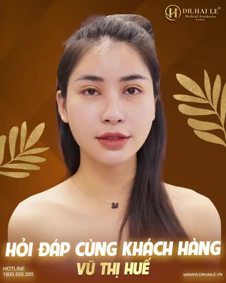 Vị khách hàng đã từng thực hiện cắt mí tại cơ sơ thẩm mỹ kém uy tín, khiến cho đôi mắt không cân đối, lờ đờ, thiếu sức sống...