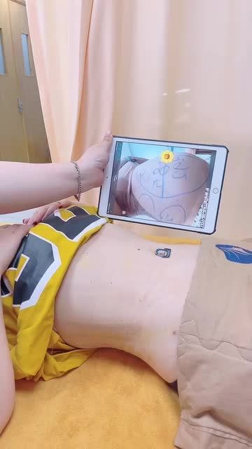 HÚT MỠ LOẠI BỎ MỠ THỪA HIỆU QUẢ NHƯ THẾ NÀO?