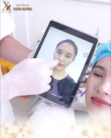 "Em tự ti lắm luôn vì makeup cũng không thể giúp em làm đầy má hay thái dương, cảm giác mình bị già hơn tuổi rất nhiều"