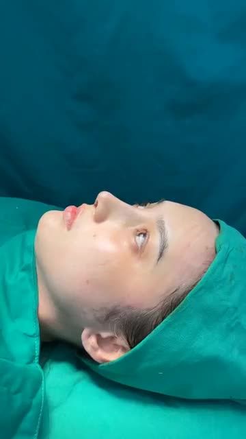 Case mũi siêu cấu trúc vừa hoàn thành