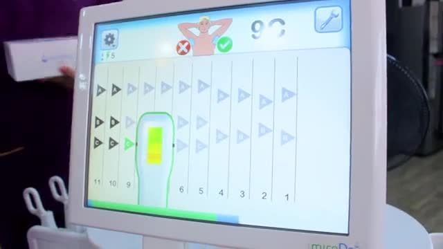 Điều trị hôi nách công nghệ miraDry hiệu quả vượt trội hơn 60 quốc gia trên thế giới tin dùng