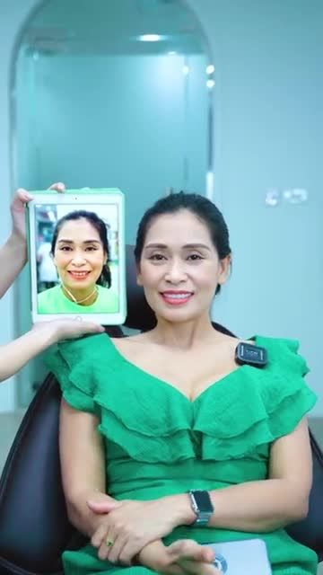 SO SÁNH THỰC TẾ TÌNH TRẠNG RĂNG TRƯỚC VÀ SAU CỦA NỮ KHÁCH HÀNG TÁI KHÁM SAU HAI NĂM THẨM MỸ RĂNG SỨ