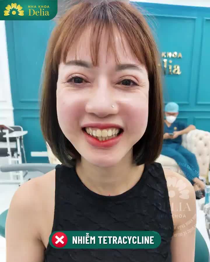 Cảm ơn vị khách hàng đáng yêu Thu Hằng đã trao cơ hội để Delia được đồng hành cùng chị trên hành trình kiến tạo nụ cười tự tin tỏa sáng.