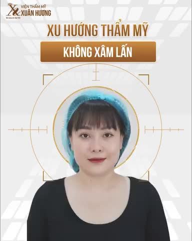Làm thế nào mà khuôn mặt ca sĩ Minh Ngọc lại thay đổi nhanh như thế nhỉ?