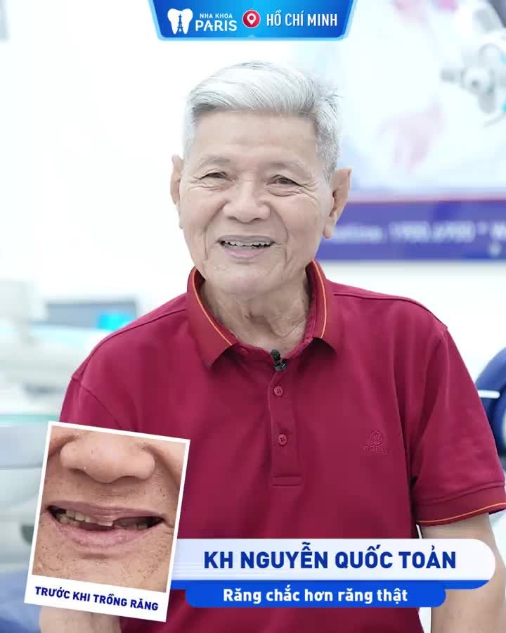 TRỒNG RĂNG IMPLANT CÓ THỰC SỰ TỐT?