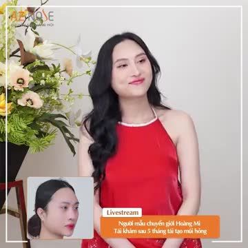 Sau 5 tháng tái tạo mũi h.ỏng, cuộc sống nàng mẫu chuyển giới thay đổi thế nào?