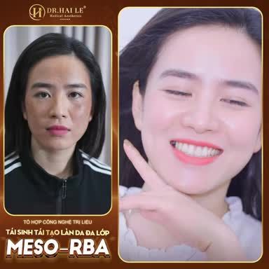 HÃY TRAO NIỀM TIN, DR.HẢI LÊ SẼ TRAO CHO BẠN SỰ TỰ TIN