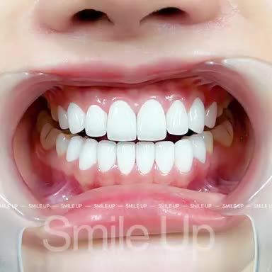 NỤ CƯỜI HOÀN MỸ - BÍ KÍP THÀNH CÔNG CỦA PHÁI ĐẸP
