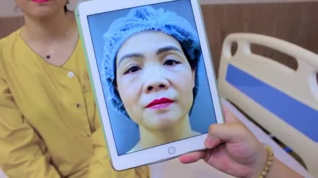 Mí mắt lỗi hỏng được Dr.Hải Lê khắc phục thành công như thế nào? Cả nhà cùng theo dõi