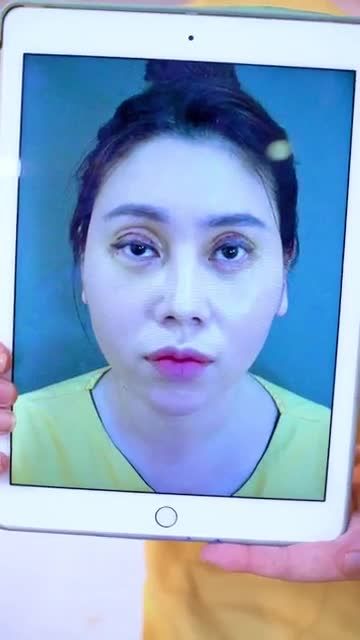 Giải cứu ca mí lỗi hỏng thời điểm vàng 0-12 thành công ngoài sự mong đợi