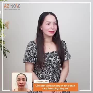 Khách hàng 8X đến từ BRVT chia sẻ cảm nhận sau 1 tháng tái tạo dáng mũi bởi Bác sĩ CKI. Nguyễn Hoàng Nam