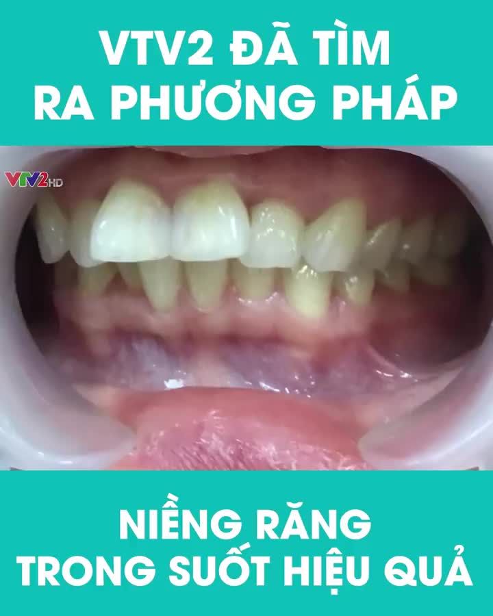 Bạn đã sẵn sàng hành trình chỉnh nha với khay niềng Invisalign cùng Ths.Bs Nguyễn Tuấn Dương chưa?