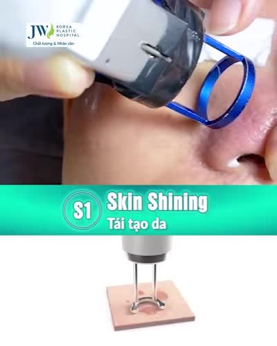 Lựa chọn hoàn hảo cho Nữ Doanh Nhân GIỮ MÃI SẮC XUÂN, CHẠM ĐỈNH THÀNH CÔNG