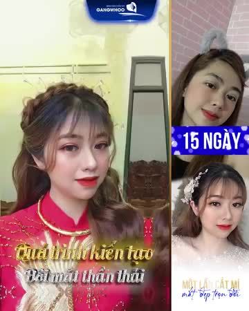 CẮT MÍ XONG BAO LÂU THÌ ĐẸP?