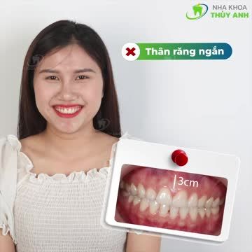 CUỘC CÁCH MẠNG THAY ĐỔI NỤ CƯỜI ĐÃ THÀNH CÔNG CHỈ SAU 45P CHỮA HỞ LỢI