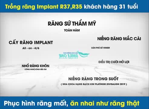 Trồng răng implant khách hàng Lê Thanh Tùng.