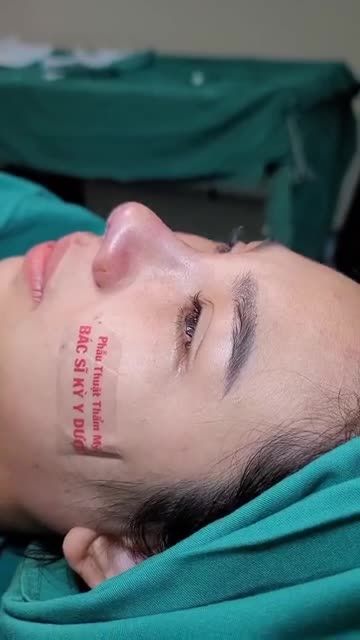 Bạn muốn sở hữu một dáng mũi thanh tú, thẳng và có độ lượn nhẹ nhàng?
