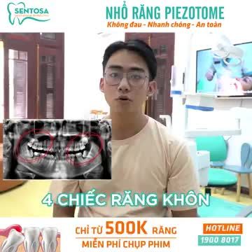 NHỔ RĂNG KHÔN VỚI PIEZOTOME: NHẸ NHÀNG, NHANH CHÓNG CHỈ TỪ 500K/RĂNG